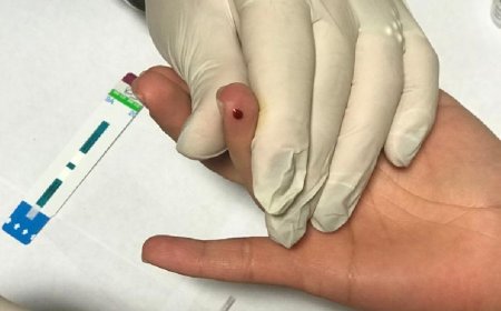 En testeo de VIH fueron detectados seis casos positivos en la ciudad de Salta