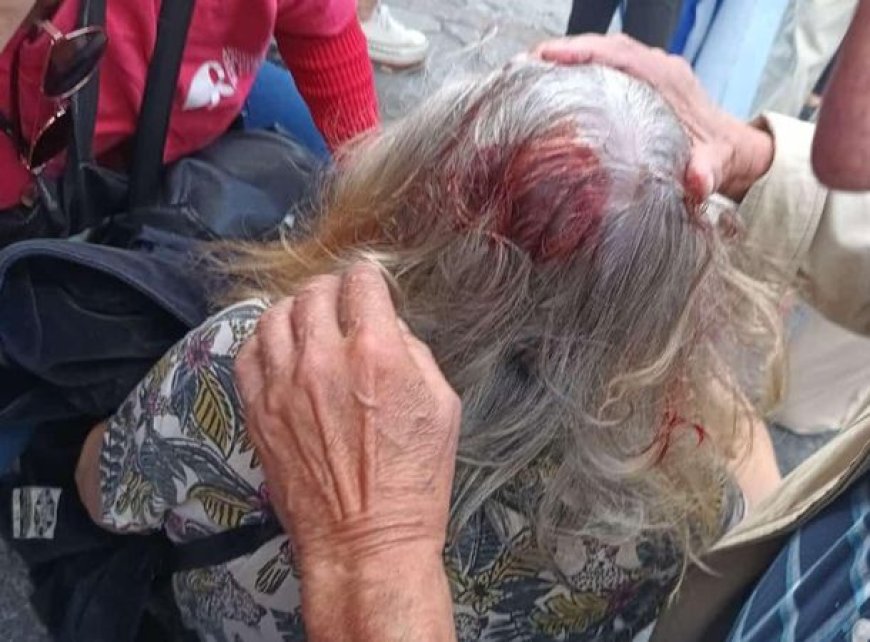 Feroz represión policial en la marcha de hinchas y jubilados: varios detenidos y dos heridos de gravedad